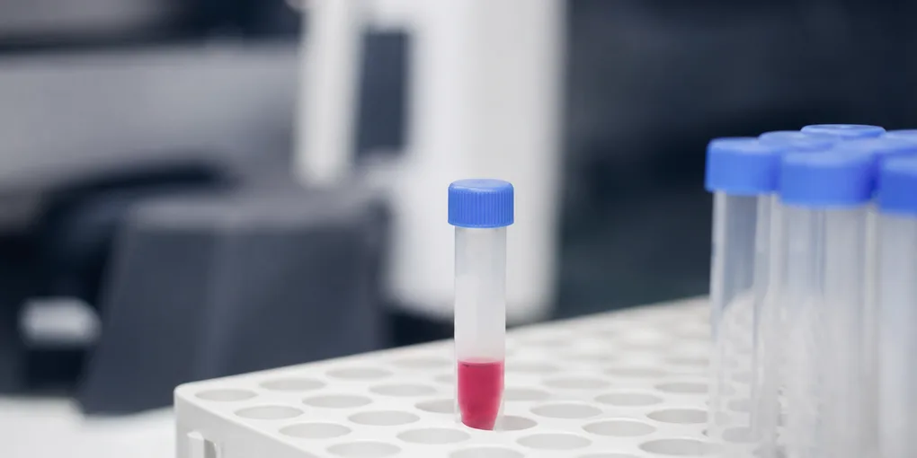 HPV Virüsü Bulaşması Aldatmanın Delili Sayılır mı?